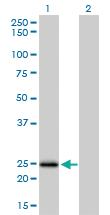 Anti-NUDT5 Mouse Monoclonal Antibody [clone: 2A3]