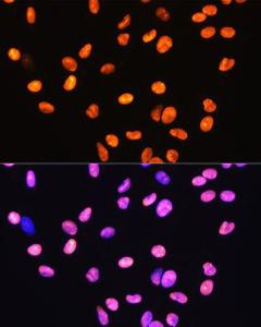 Anti-HMGB1 Rabbit Monoclonal Antibody [clone: ARC0001]