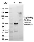 SDS-PAGE analysis of Anti-CD5 Antibody [C5/6463R] under non-reduced and reduced conditions; showing intact IgG and intact heavy and light chains, respectively. SDS-PAGE analysis confirms the integrity and purity of the antibody