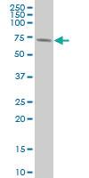 Anti-RPS6KB1 Mouse Monoclonal Antibody [clone: 4H4]