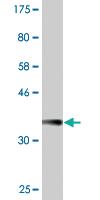 Anti-MYO3A Mouse Monoclonal Antibody [clone: 5A12]