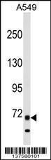 Anti-ITK Rabbit Polyclonal Antibody (Biotin)