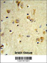 Anti-PEX14 Rabbit Polyclonal Antibody (FITC (Fluorescein Isothiocyanate))