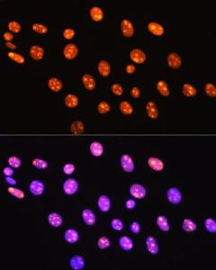 Anti-HMGB1 Rabbit Monoclonal Antibody [clone: ARC0001]