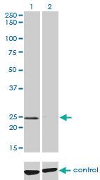 Anti-NUDT5 Mouse Monoclonal Antibody [clone: 2A3]