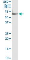 Anti-CYP46A1 Antibody Pair