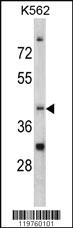 Anti-CCRN4L Rabbit Polyclonal Antibody