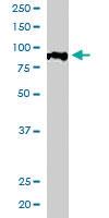 Anti-ACAP1 Goat Polyclonal Antibody