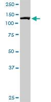 Anti-IMP7 Mouse Monoclonal Antibody [clone: 4G6]