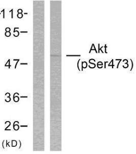 Western blot analysis of lysates from HeLa cells treated with heat shock using Anti-Akt (phospho Ser473) Antibody. The left hand lane represents a negative control, where the antibody is blocked by the immunising peptide