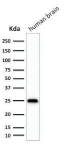 Western blot analysis of human brain tissue lysate using Anti-PGP9.5 Antibody [SPM575]