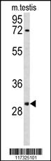 Anti-RPA2 Rabbit Polyclonal Antibody