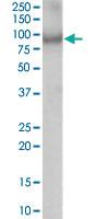 Anti-ACAP2 Goat Polyclonal Antibody