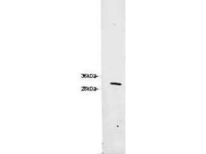 Anti-RFP antibody trial size