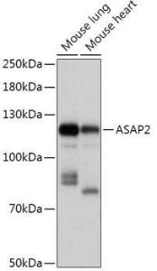 Western blot analysis of extracts of various cell lines, using Anti-ASAP2 Antibody (A307593) at 1:1,000 dilution The secondary antibody was Goat Anti-Rabbit IgG H&L Antibody (HRP) at 1:10,000 dilution Lysates/proteins were present at 25 µg per lane