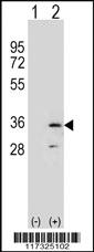 Anti-RPA2 Rabbit Polyclonal Antibody