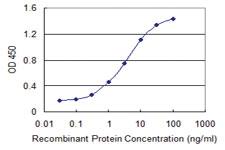 Anti-IMP7 Mouse Monoclonal Antibody [clone: 4G6]