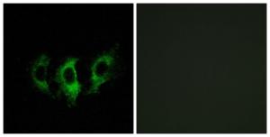 Immunofluorescence analysis of A549 cells using Anti-GFM2 Antibody The right hand panel represents a negative control, where the antibody was pre-incubated with the immunising peptide