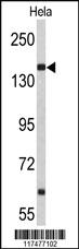 Anti-NUP153 Rabbit Polyclonal Antibody