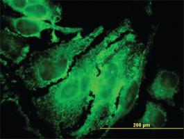 Anti-RPS6KB1 Mouse Monoclonal Antibody [clone: 4H4]