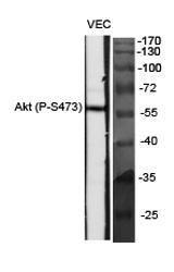 Western blot analysis of various cells using Anti-Akt (phospho Ser473) Antibody