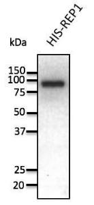 Anti-REP1 Antibody at a 1:1,000 dilution, 50ng of recombinant protein, and rabbit anti-goat IgG antibody (HRP) at a 1:10,000 dilution