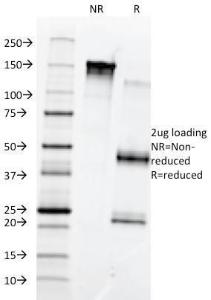 SDS-PAGE analysis of Anti-Fibronectin Antibody [568] under non-reduced and reduced conditions; showing intact IgG and intact heavy and light chains, respectively SDS-PAGE analysis confirms the integrity and purity of the antibody