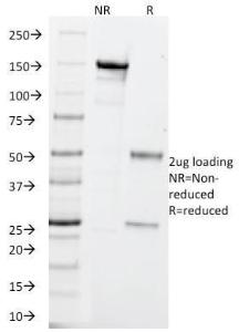 SDS-PAGE analysis of Anti-PGP9.5 Antibody [SPM575] under non-reduced and reduced conditions; showing intact IgG and intact heavy and light chains, respectively. SDS-PAGE analysis confirms the integrity and purity of the antibody.