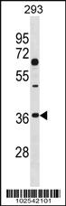 Anti-DKK2 Rabbit Polyclonal Antibody