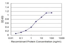 Anti-RPS6KB1 Mouse Monoclonal Antibody [clone: 4H4]