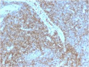 Anti-CD44 Rabbit Recombinant Antibody [clone: HCAM/2875R]