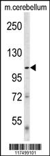 Anti-Denatured ATG1 Rabbit Polyclonal Antibody