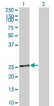 Anti-TAZ Mouse Monoclonal Antibody [clone: 1F9]