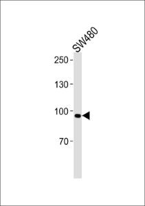 Anti-ANO6 Rabbit Polyclonal Antibody (FITC (Fluorescein Isothiocyanate))