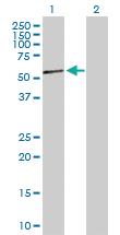 Anti-NR2F2 Rabbit Polyclonal Antibody