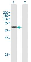 Anti-RPS6KB2 Mouse Polyclonal Antibody