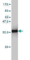 Anti-CX3CR1 Mouse Monoclonal Antibody [clone: 2B11]