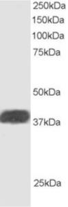 EB05869 staining (1 µg/ml) of Human Heart lysate (RIPA buffer, 30 µg total protein per lane). Primary incubated for 1 hour. Detected by western blot using chemiluminescence.