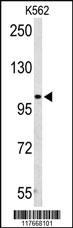 Anti-DUSP15 Rabbit Polyclonal Antibody