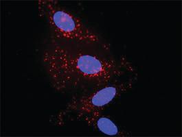 Anti-IL1B + A2M Antibody Pair