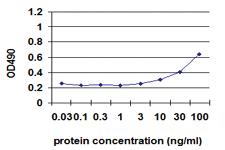 Anti-IL1B Antibody Pair