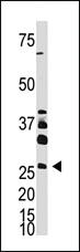 Anti-DKK4 Rabbit Polyclonal Antibody