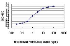 Anti-MYBPC1 Mouse Monoclonal Antibody [clone: 3G4]