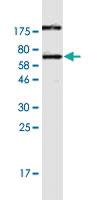 Anti-CALU Mouse Monoclonal Antibody [clone: 6C8]