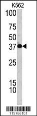 Anti-CFHR1 Rabbit Polyclonal Antibody