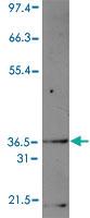 Anti-CDCA8 Rabbit Polyclonal Antibody