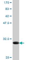 Anti-CX3CR1 Mouse Monoclonal Antibody [clone: 10D5]