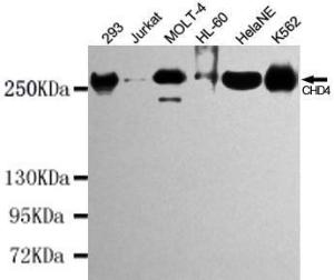 Anti-CHD4 Mouse Monoclonal Antibody [clone: 13k32]