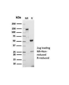 SDS-PAGE analysis of Anti-CD5 Antibody [C5/7020R] under non-reduced and reduced conditions; showing intact IgG and intact heavy and light chains, respectively. SDS-PAGE analysis confirms the integrity and purity of the antibody