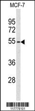 Anti-ADAMDEC1 Rabbit Polyclonal Antibody